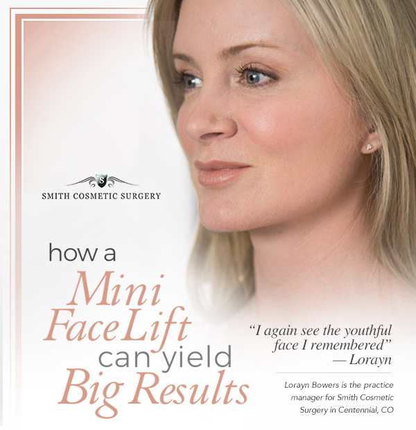 mini facelift patient closeup at Smith Cosmetic Surgery in Denver