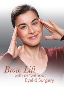 graphic representation of a brow lift