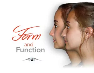 closeup image of women highlighting plastic surgery of the nose