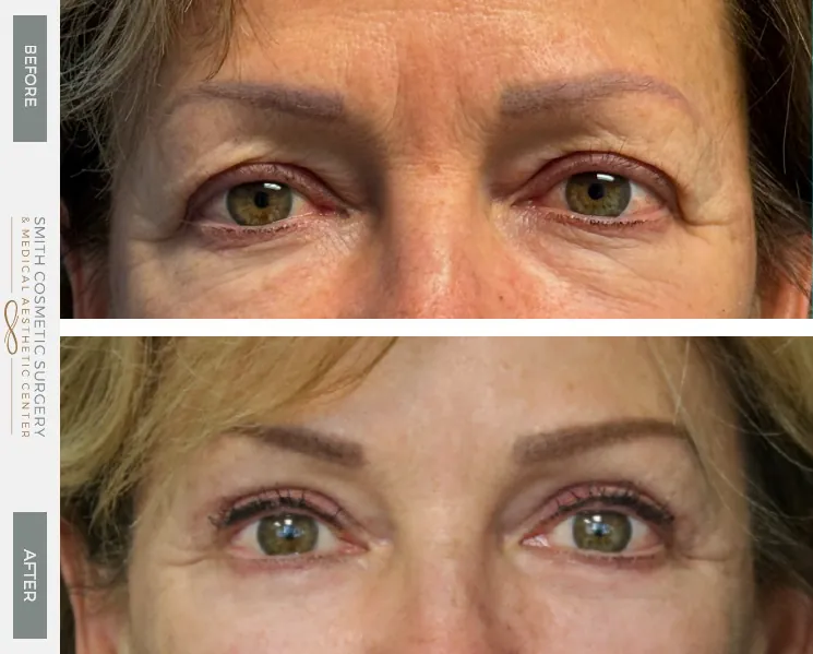 01eyes_brows_before_after-1.jpg