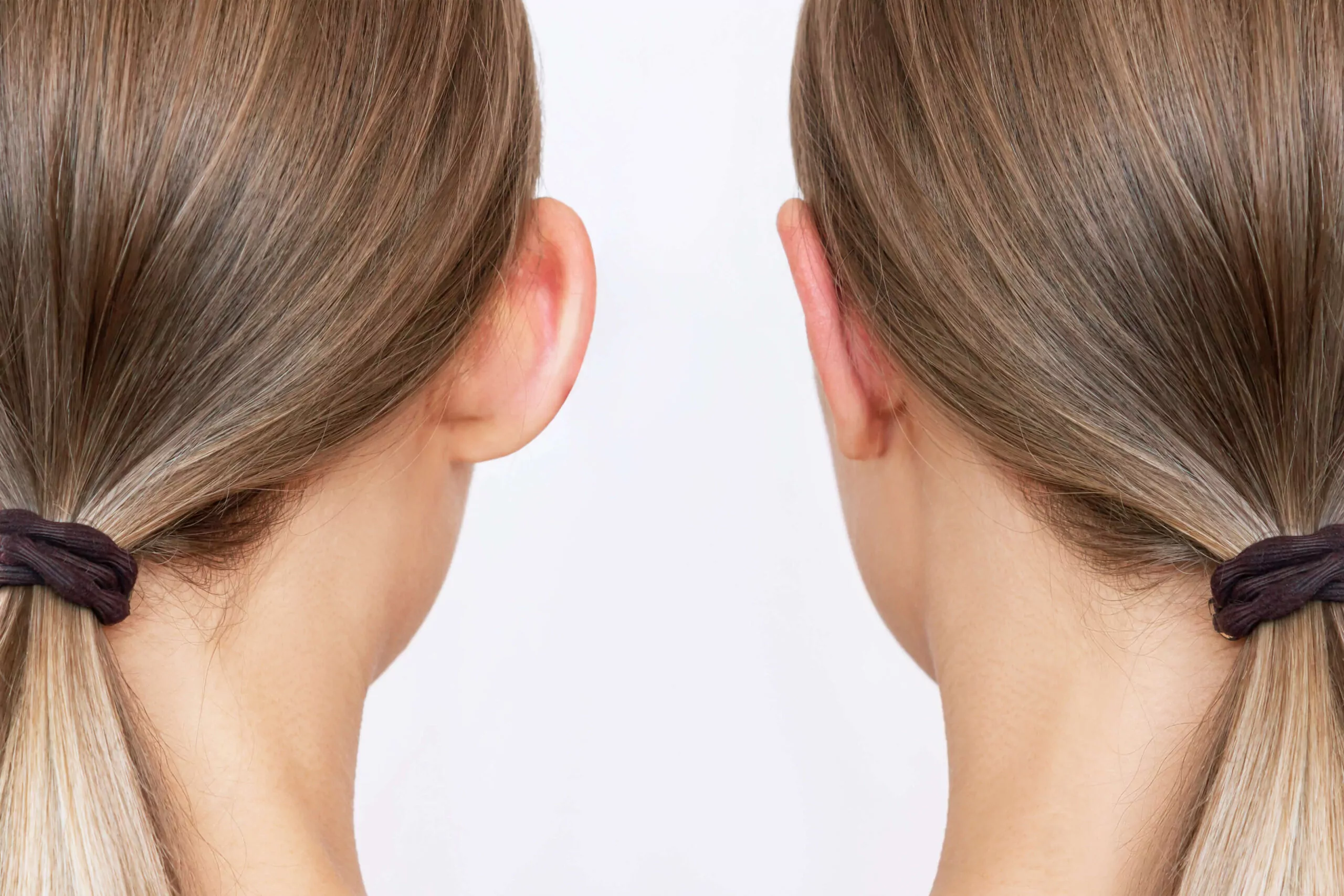 DENVER-EAR-SURGERY