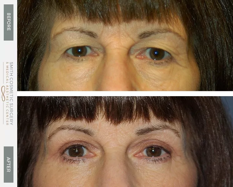 Eyes-And-Brows-4.jpg