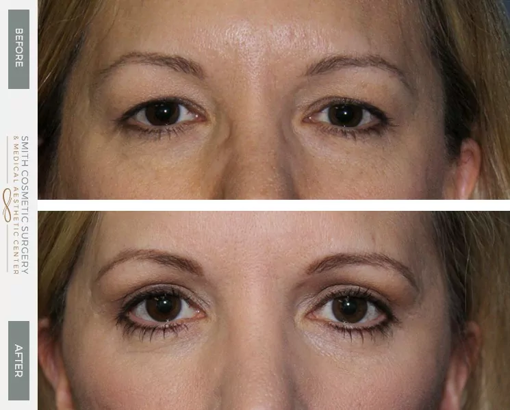 Eyes-And-Brows-6.jpg