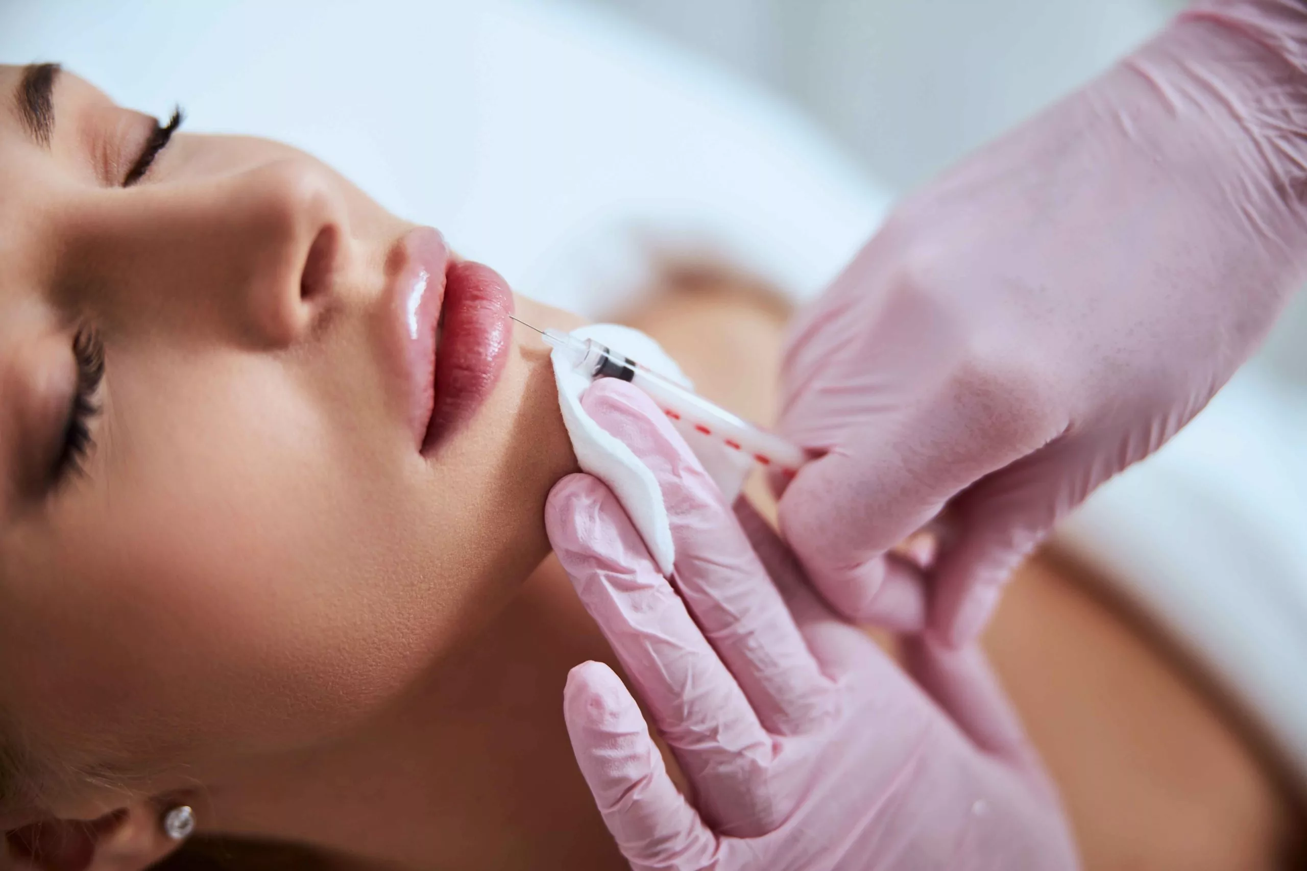 dermalfillers