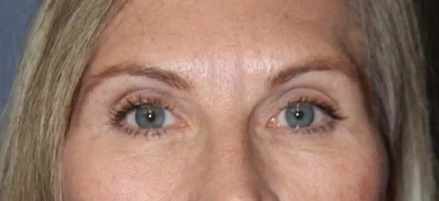 After image