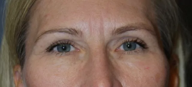 Before image