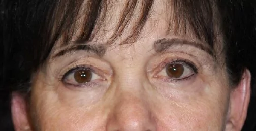 Before image
