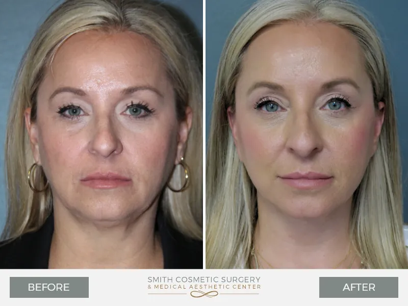1_Smith-Cosmetic-1.jpg