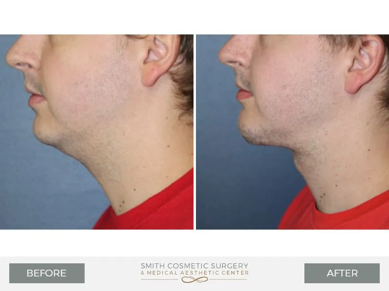 3_Smith-Cosmetic.jpg