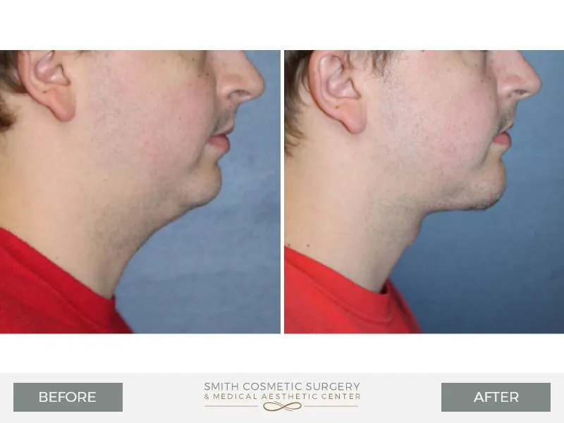 4_Smith-Cosmetic.jpg